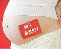 怀孕期间可以做亲子鉴定吗 