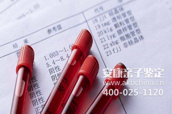 上海亲子鉴定中心对血型血液判断的鉴定方法 