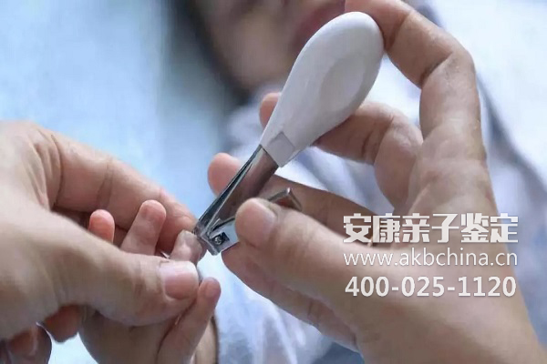 上海用指甲做亲子鉴定多少钱 