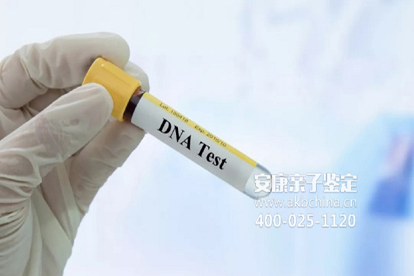 DNA为什么需要做亲子鉴定 