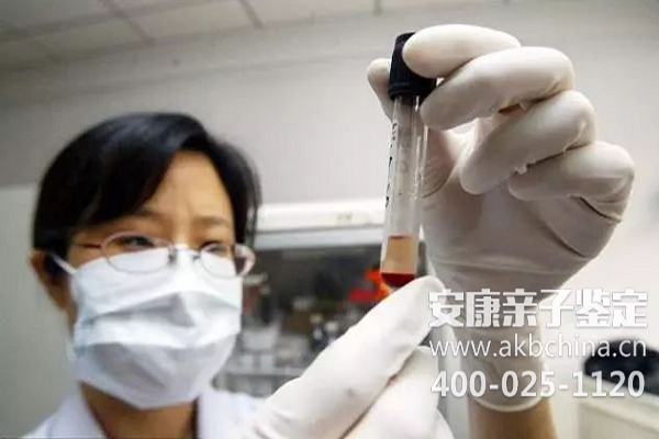 上海亲子鉴定样本采集大全,做亲子鉴定口腔细胞怎么采集？ 