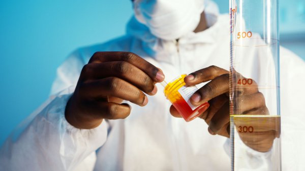 微量降解 DNA 样本检测解决方案